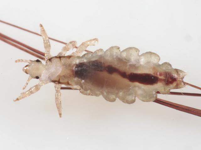 Pediculus humanus capitis Head louse lice knits nits Phthiraptera Images