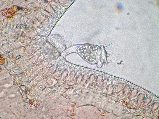 Epistylididae Epistylidid ciliate protozoan on the gills and tentacles of the polychaete worm Terebella lapidaria Ciliophora images