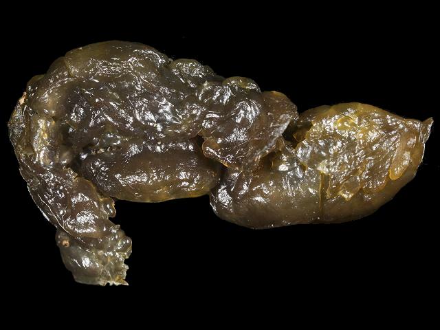 Nostoc commune Witches Butter Cyanobacterium terrestrial Cyanobacteria or Blue-green Algae Images