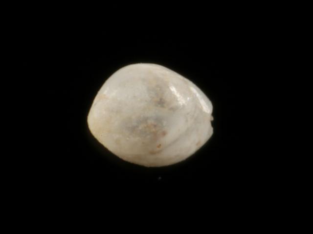 Globulina gibba Hole Bearer or Foram Foraminifera Images