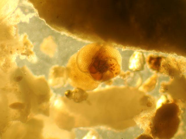 Rosalina globularis rosalinidae rosalinid foram Foraminifera Images