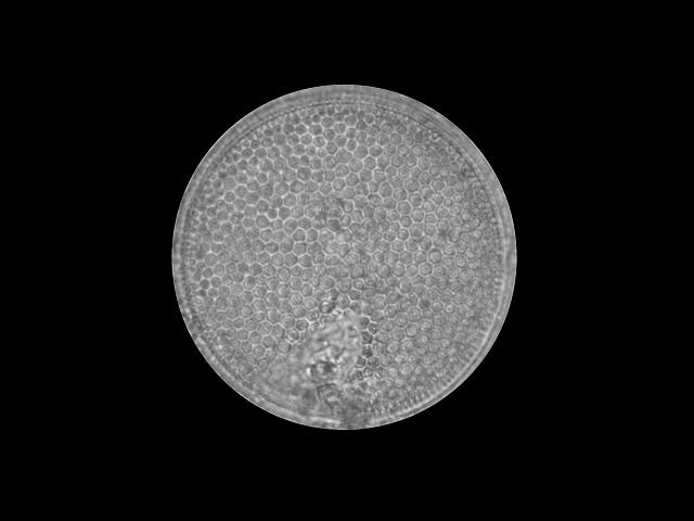 Coscinodiscus radiatus centric diatom Microalgae images