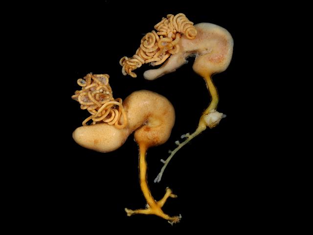 Lernaeocera branchialis cod worm parasitic sea louse copepod images
